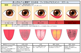 あっかんべぇ運動